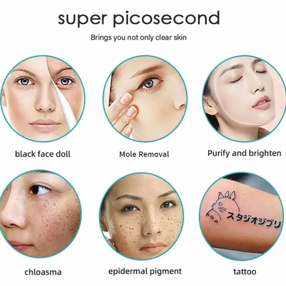 Máquina de eliminación de tatuajes GURSAC Picosecond 220 V 808 nm láser de diodo