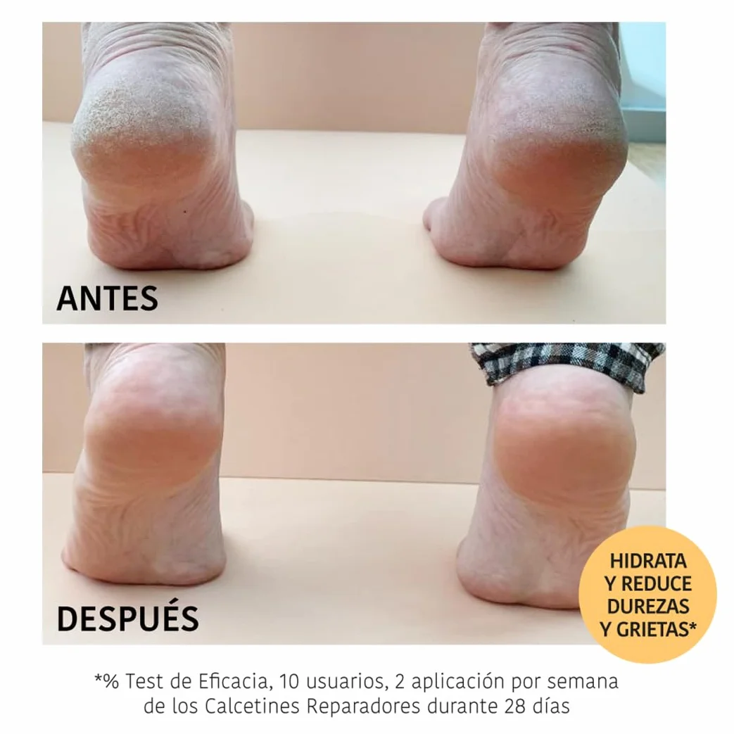 IROHA NATURE Calcetines Mascarilla Reparadores Melocotón Manteca Karité Hidratación Profunda Pies Secos Agrietados 100% Vegano