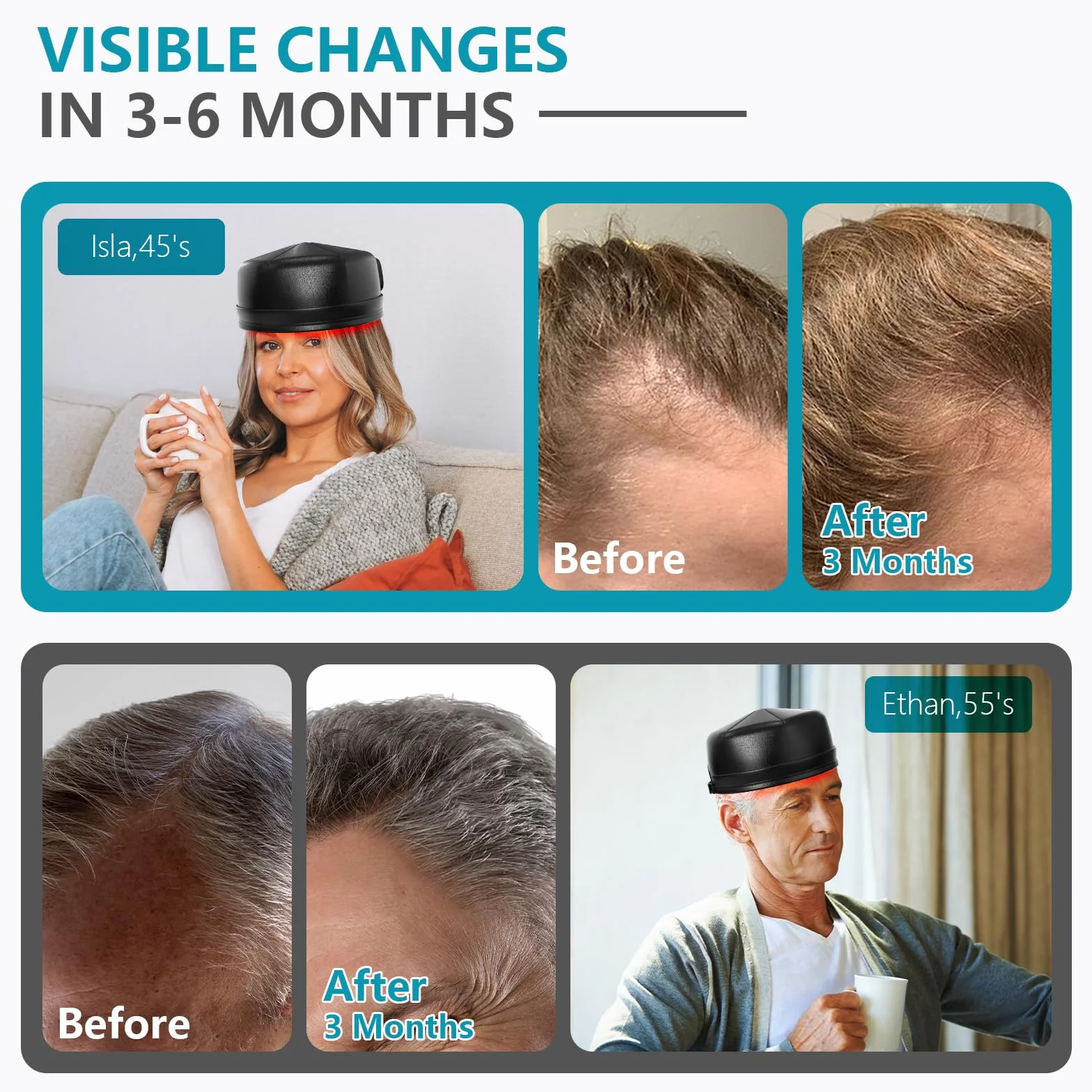 iKeener lllt Laser Capilar para Cabello, Inalámbrico 660nm & 850nm Casco Laser para Tratamientos Crecepelos, Dispositivos para Regeneración Capilar para Hombre Mujer