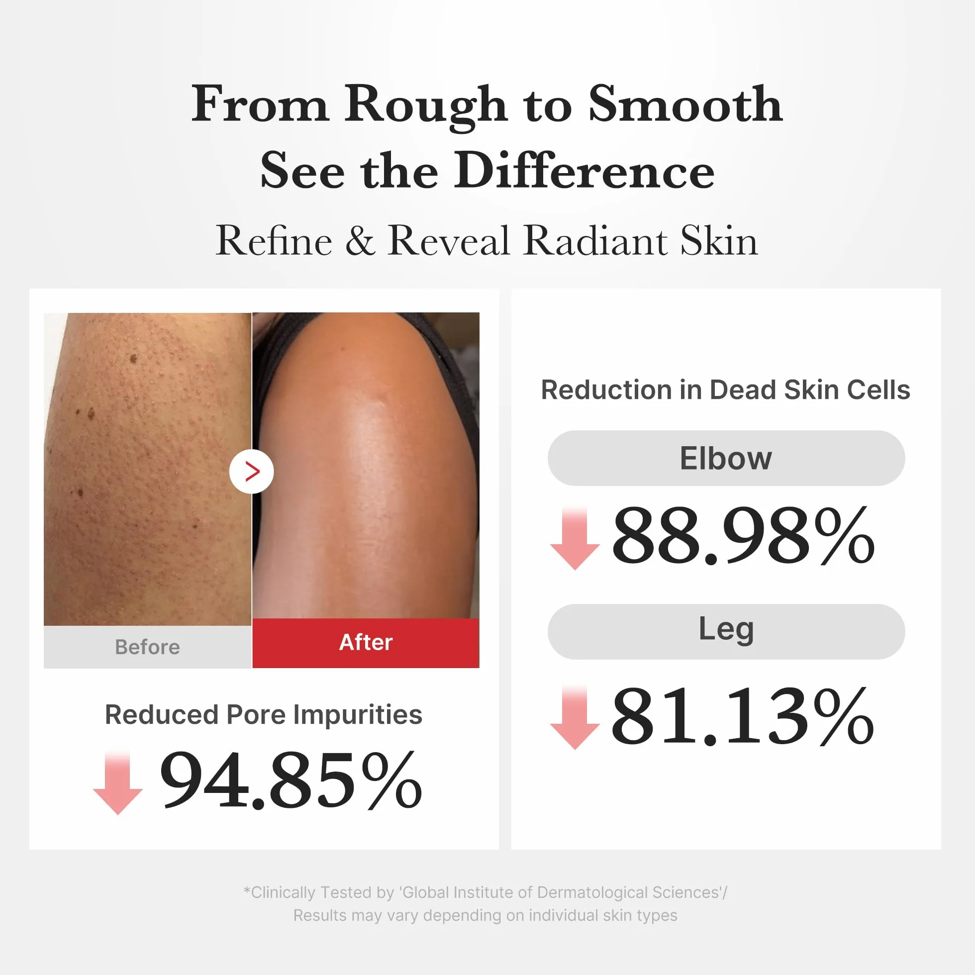 Medicube Body Peel Shot Hypochlorous Acid Gentle Body Exfoliating Serum Dead Skin Cells Rough Patches Uneven Texture Rice Extract Panthenol Hydrating Smoothing Care 9.46 fl.oz