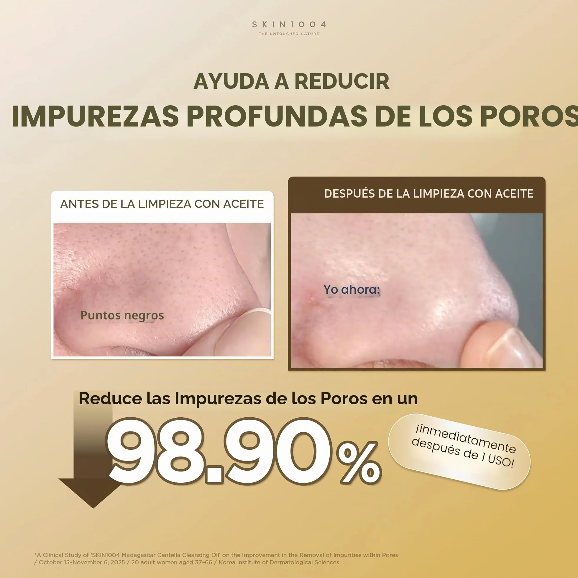 SKIN1004 Centella Aceite limpiador ligero 200 ml