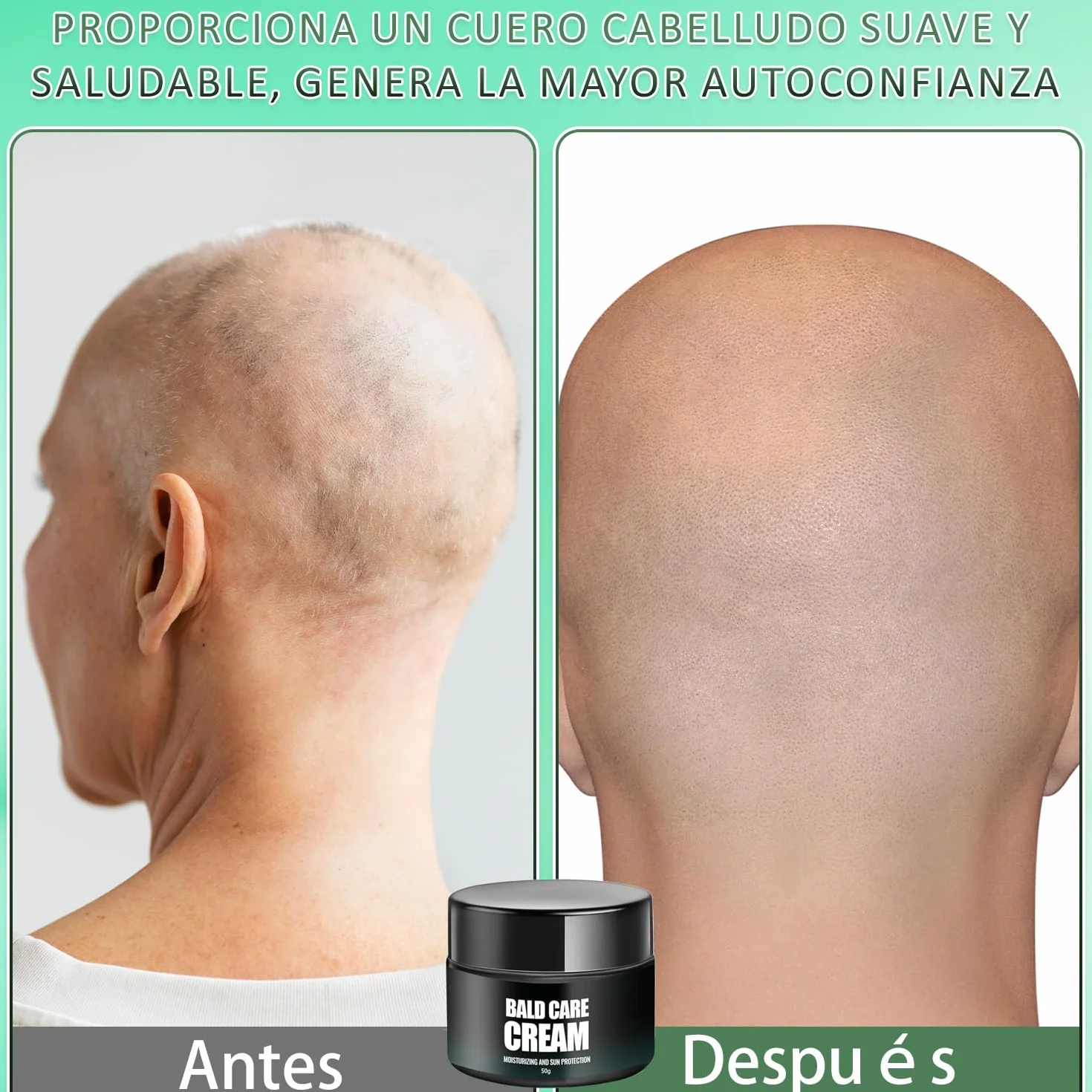 Crema Para La Calvicie Hidratante Calmante Cuero Cabelludo Efecto Antibrillo Matizante Cuidado Diario Hombres Pack de 2