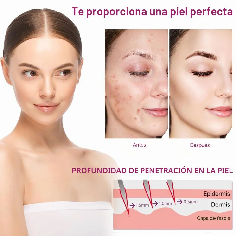 Derma Roller 6 en 1 Microneedle Roller 0.5mm+1mm+1.5mm para Cara y Cuerpo Microneedling Anti-Edad