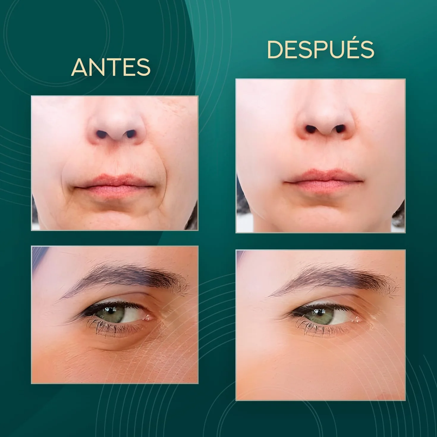 Aparato Radiofrecuencia Facial 5 en 1 Masajeador Facial Reafirmante Antiarrugas Profesional