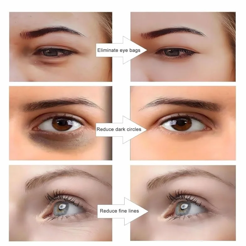 Gafas de terapia de luz roja para cuidado de la piel, reduce ojeras, hinchazón y arrugas (blanco)