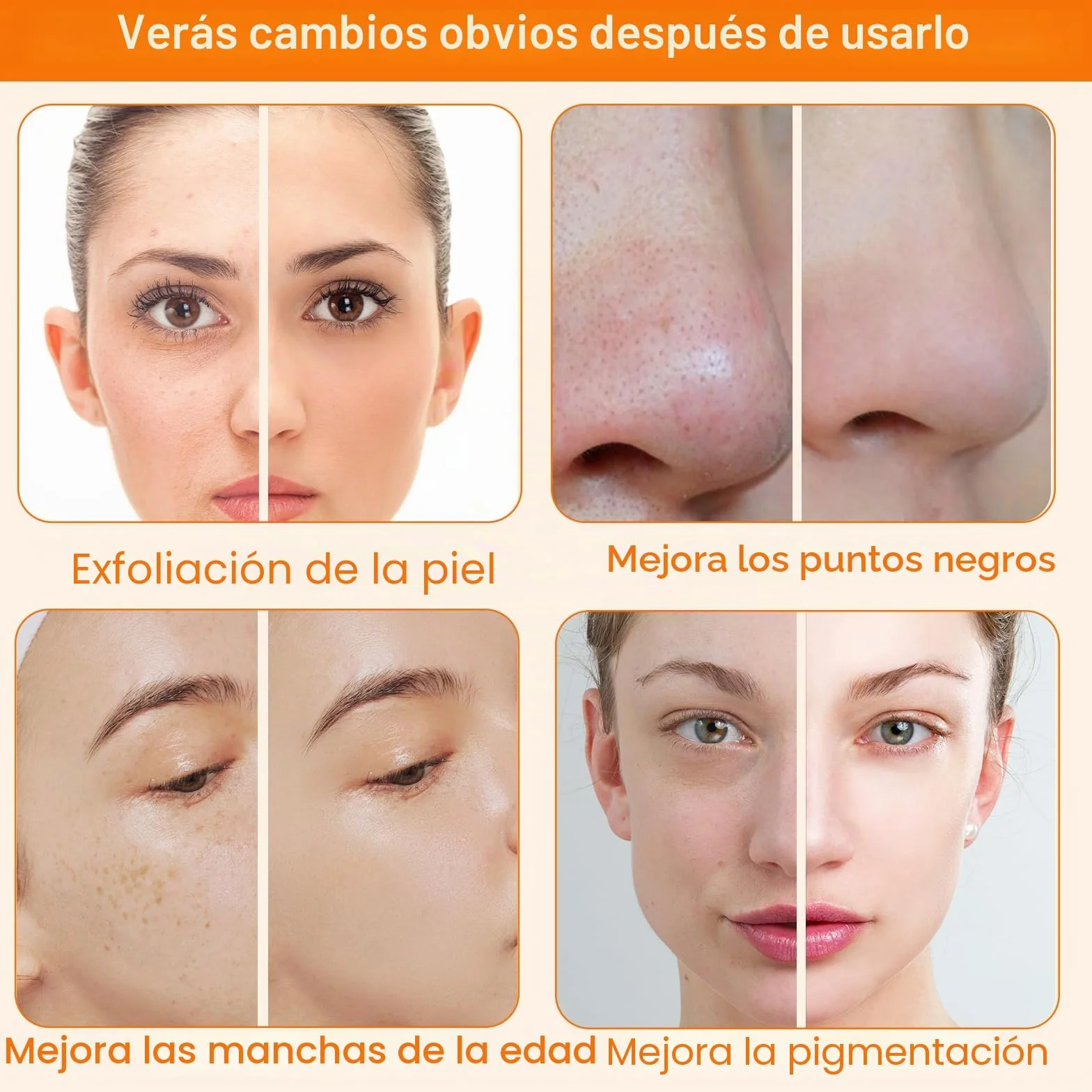 3 en 1 Dispositivo de Microdermoabrasión de Diamante, Dispositivo de Dermoabrasión para Exfoliación y Eliminación de Puntos Negros, Dispositivo de Cuidado Facial para Uso en Spa en Casa