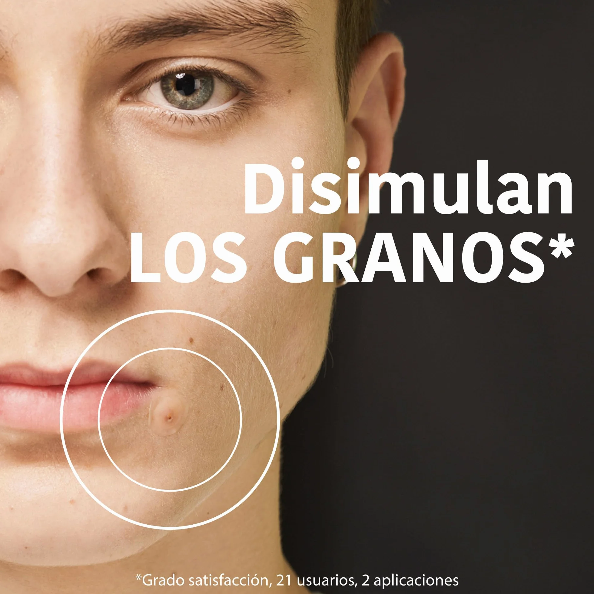 Parches para Granos con Ácido Salicílico, Árbol de Té y Centella Asiática, 18 unidades