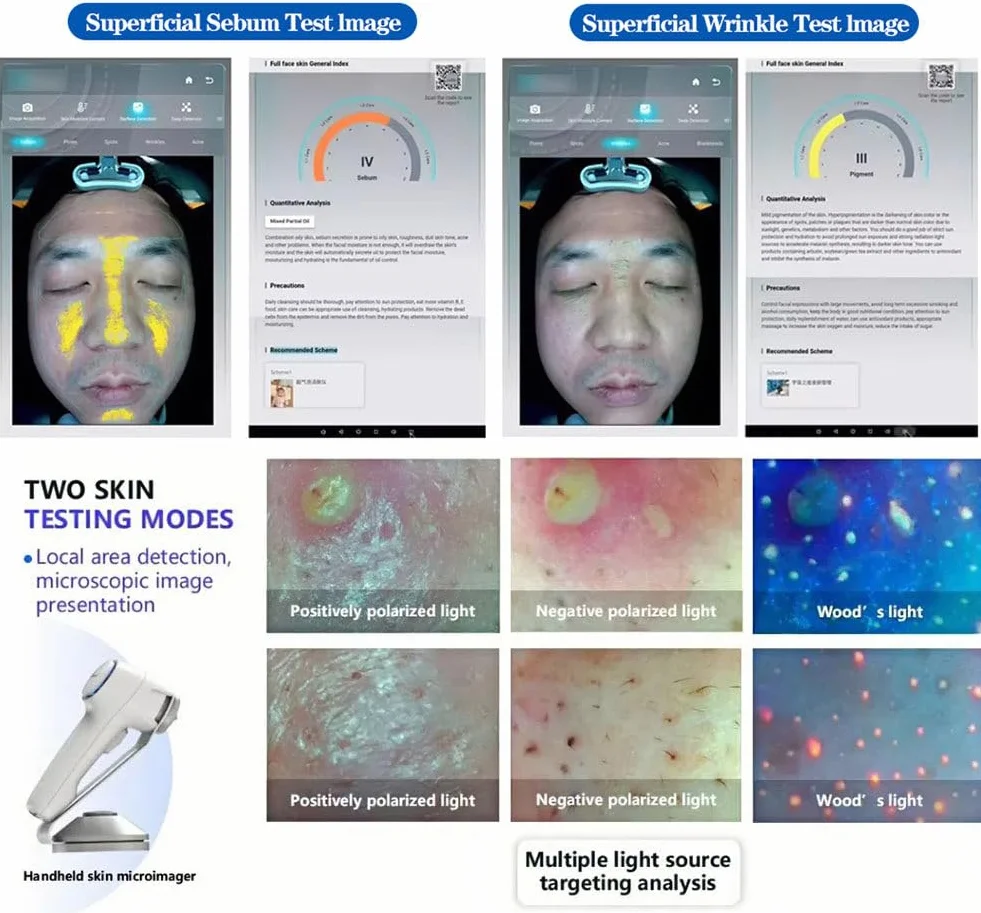 Analizador Facial Profesional de la Piel con Pantalla 21.5" - Cámara 36MP,8 Espectros,3 Modos de Informe,Informes Personalizables,Analizador de Piel 3D para Uso Profesional‌,White
