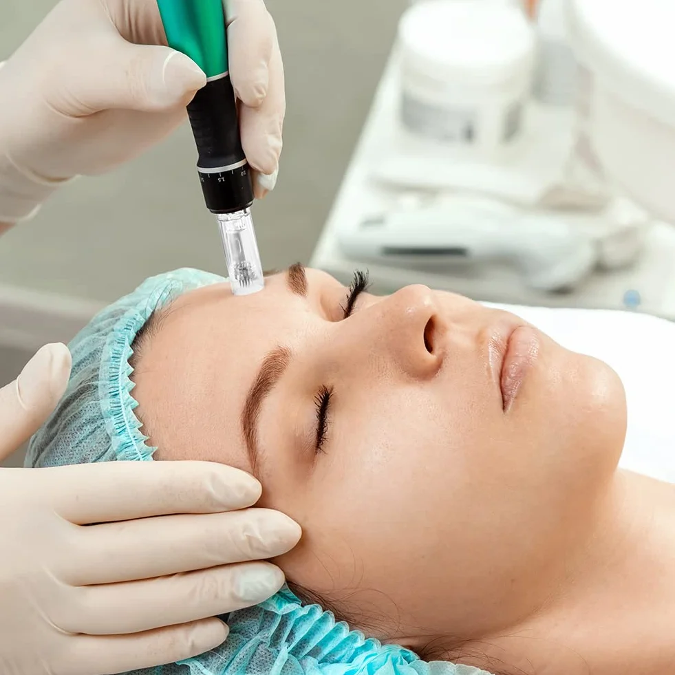 LOPHE Agujas Dermapen 36 Puntas, 12pcs Repuesto para Microneedling Pen