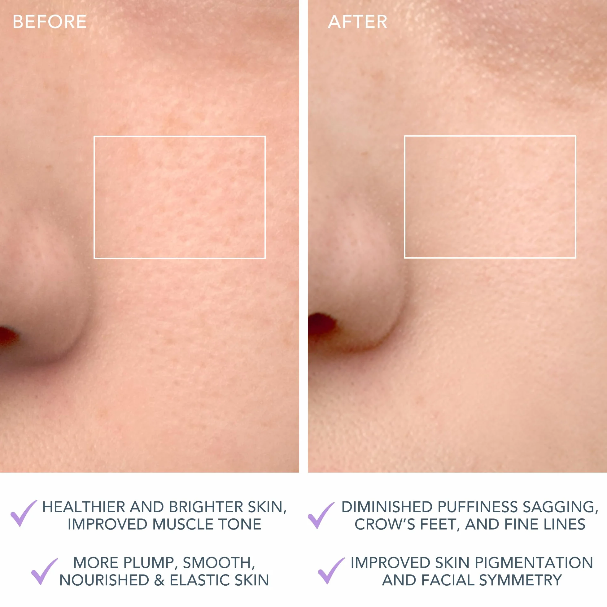 FOREO LUNA 4 Cepillo de limpieza facial reafirmante antienvejecimiento