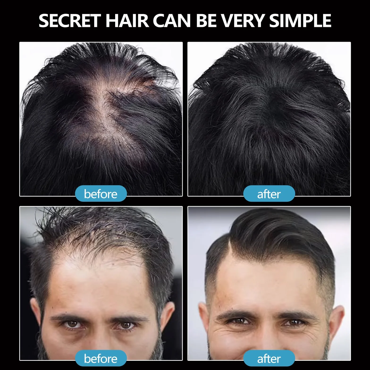 Polvos Relleno Capilar Instantáneo, Fibras Capilares, Spray en Polvo para Cubrir Pérdida de Cabello, Negro