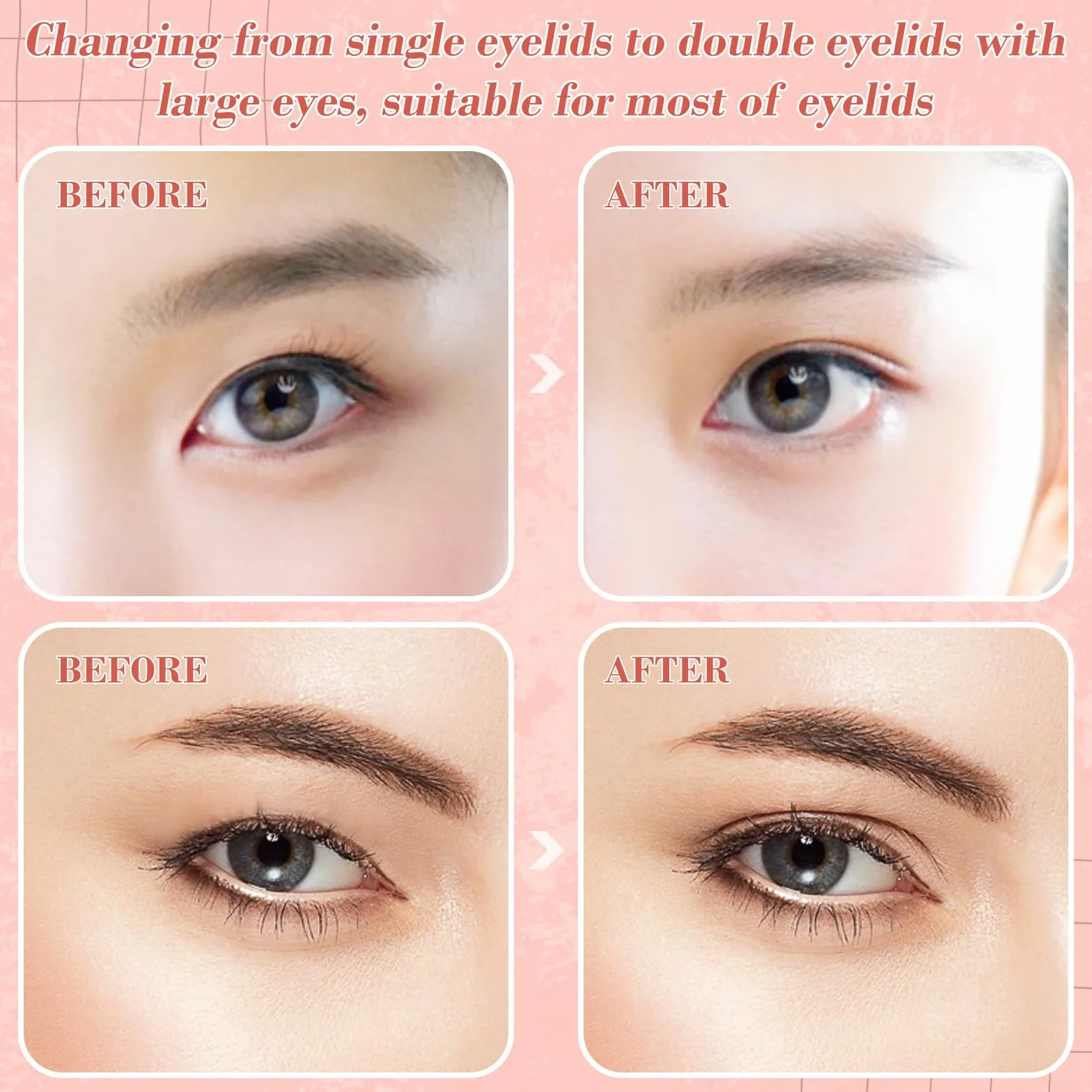 Remedio Cinta para Párpados Caídos Eyelid Lift Pegatinas L XL XXL