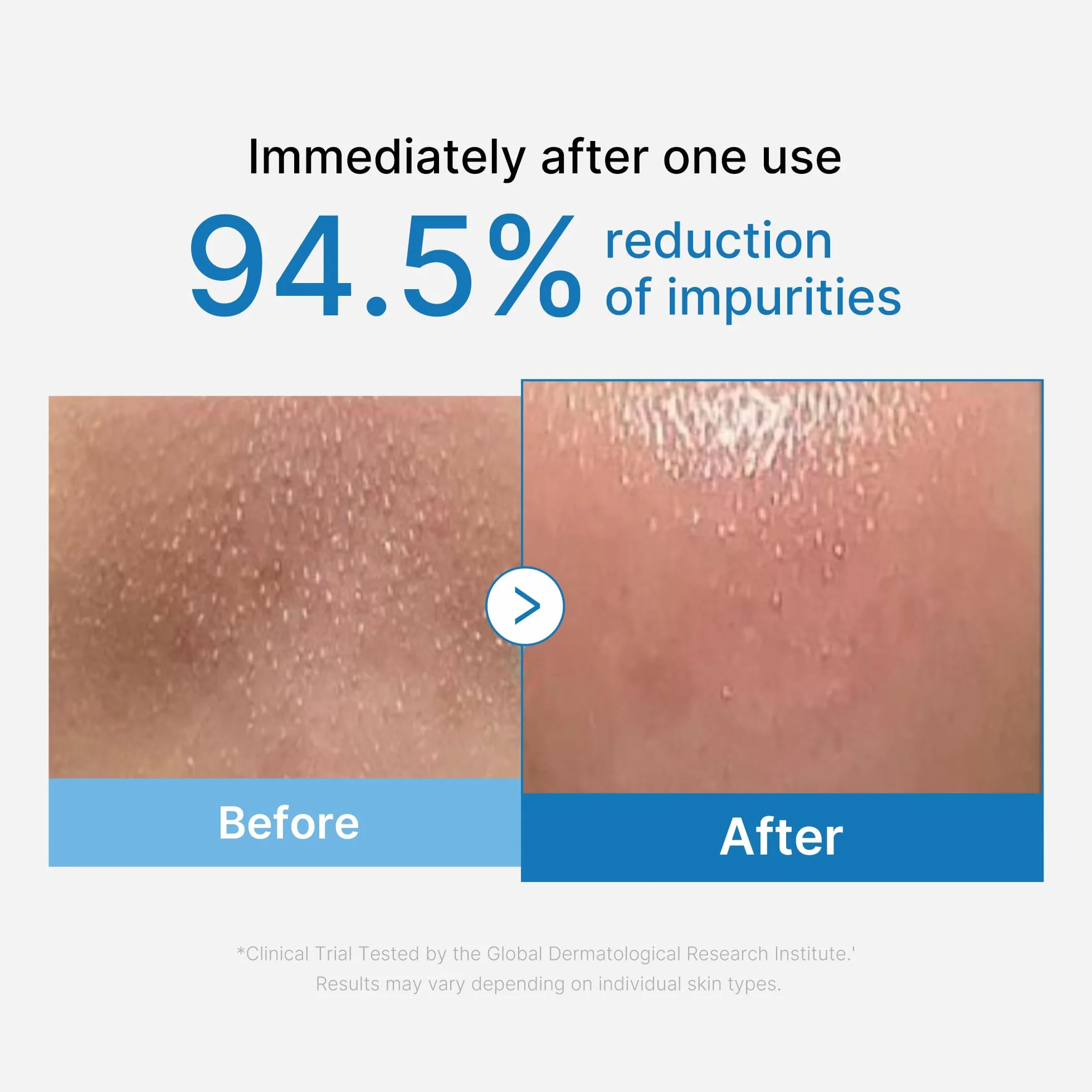 Medicube Aceite Desmaquillante Zero Pore Blackhead Limpiador Facial Hidratante 205ml