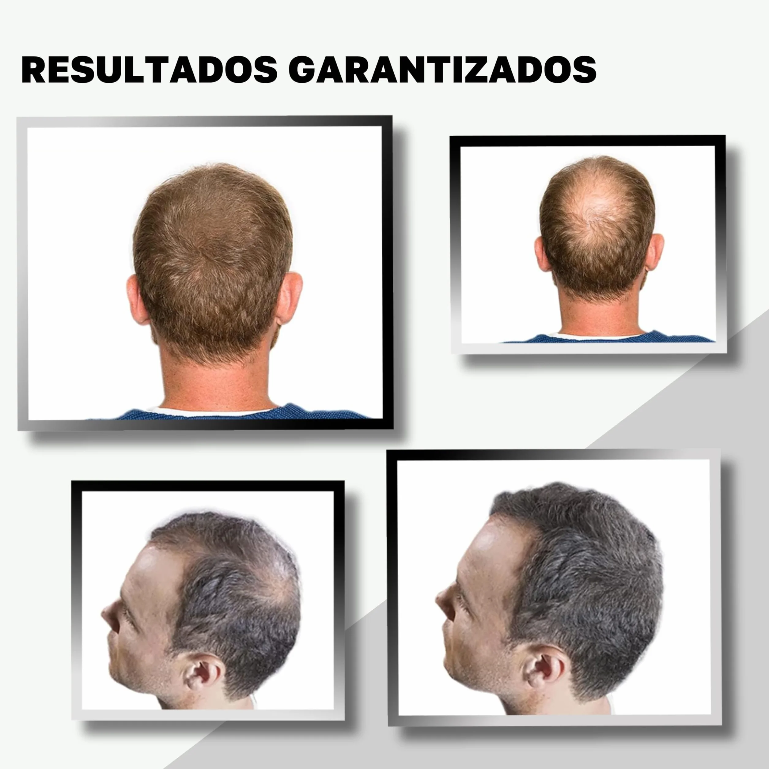 VidalForce Fibra Capilar Negro 5g Polvos Voluminizador Pelo Hair Building Fibers