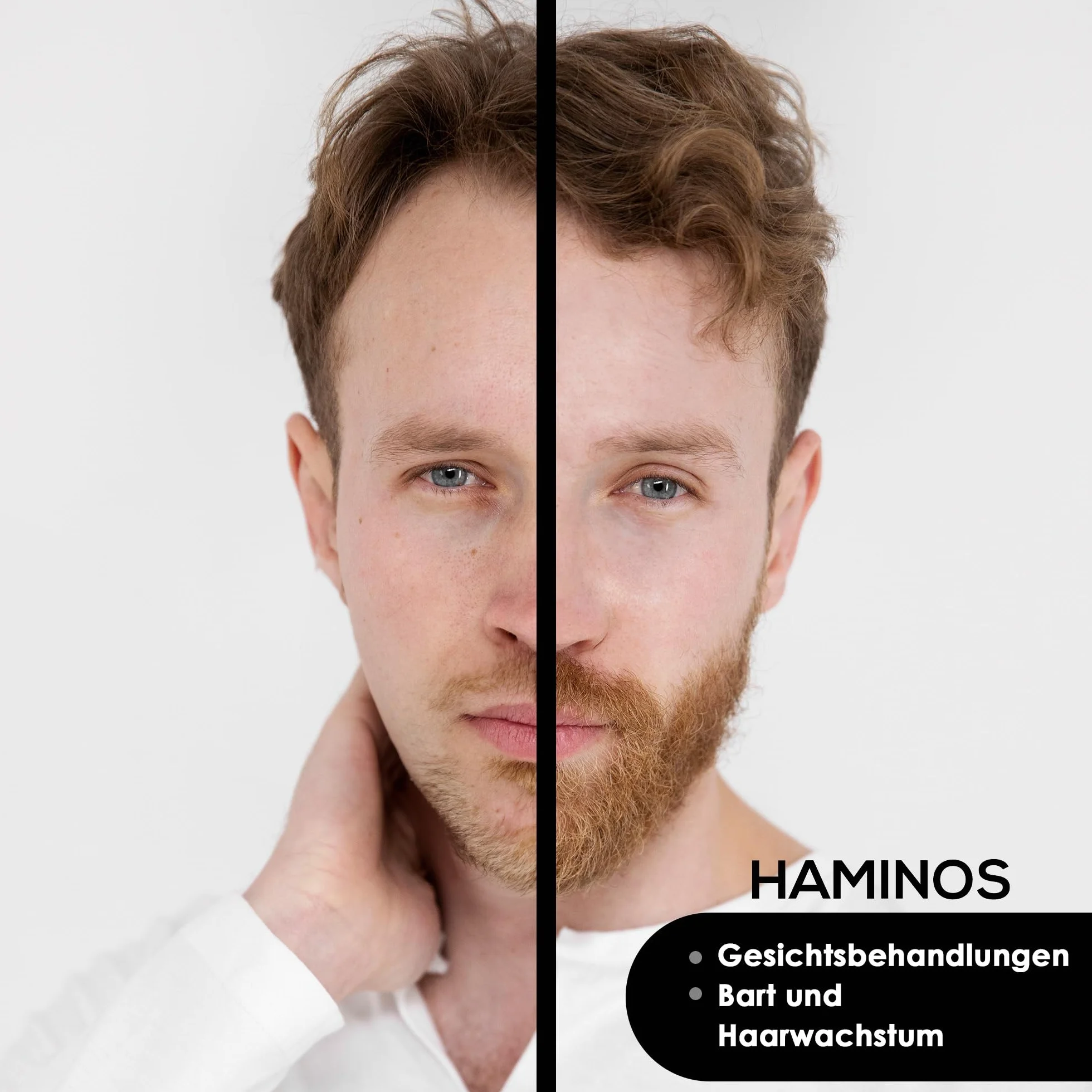 HAMINOS Cabezal 1 mm 105 Agujas de Titanio para Derma Roller
