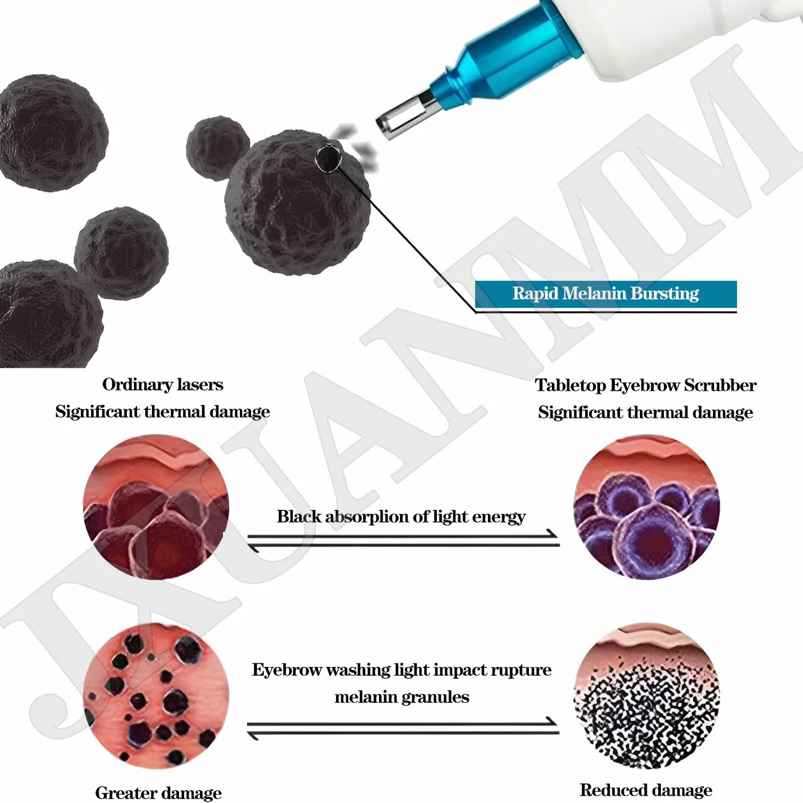 Máquina portátil de eliminación de Tatuajes con láser Pico Nd Yag con mira de Punto Rojo para rejuvenecimiento en Salones de Belleza. 6Probes