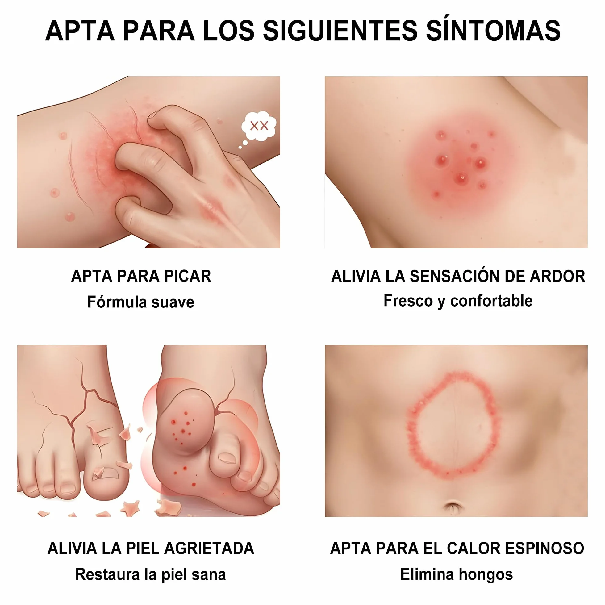 Crema antimicótica para pie de atleta, tiña inguinal y tiña - Fórmula suave - 18G 1-Pack