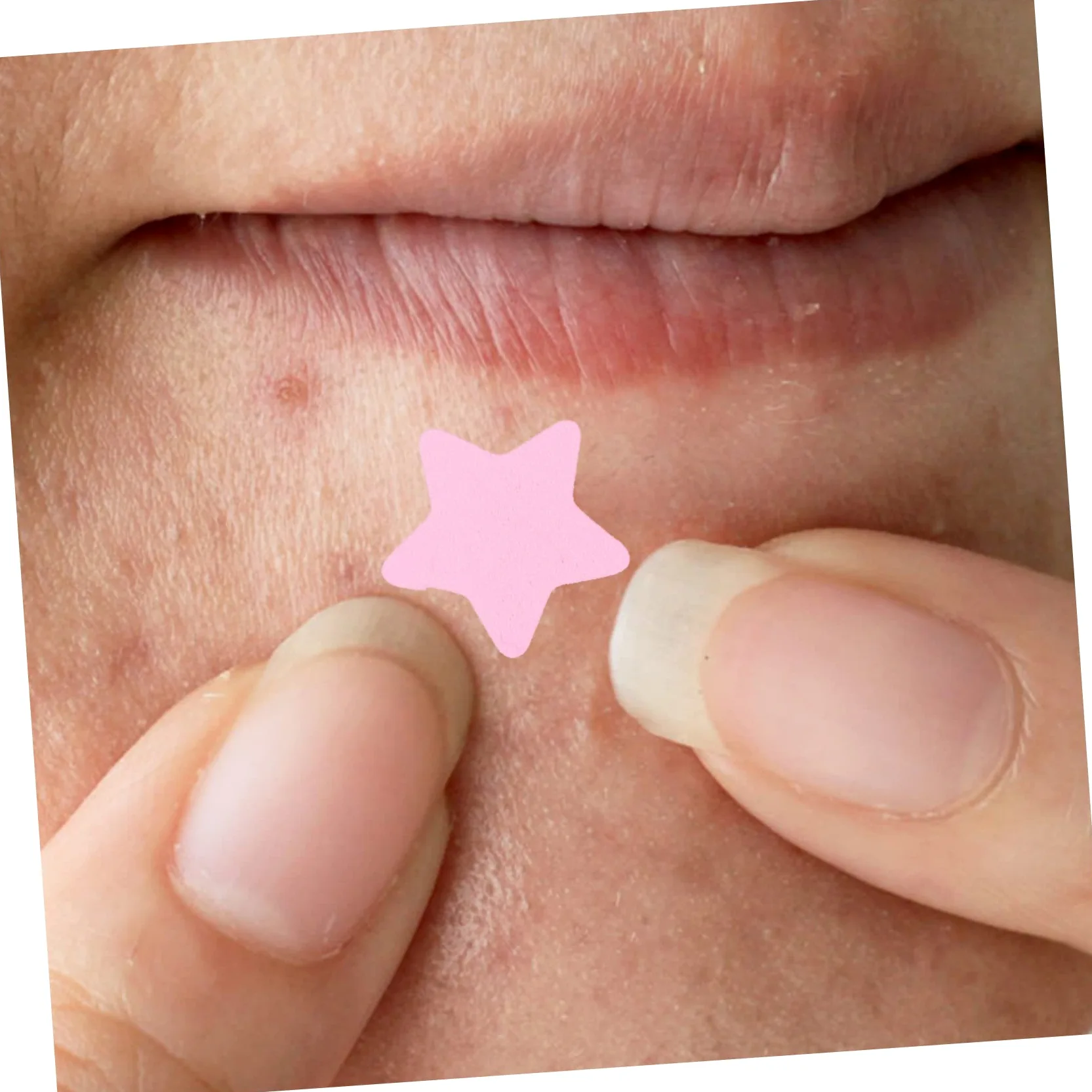 Parches Para Acné Hidrocoloides Coloridos Para Espinillas De Parches Invisibles Para Cuidado Facial Material Y Efecto Hidratante 4 Hojas X 5