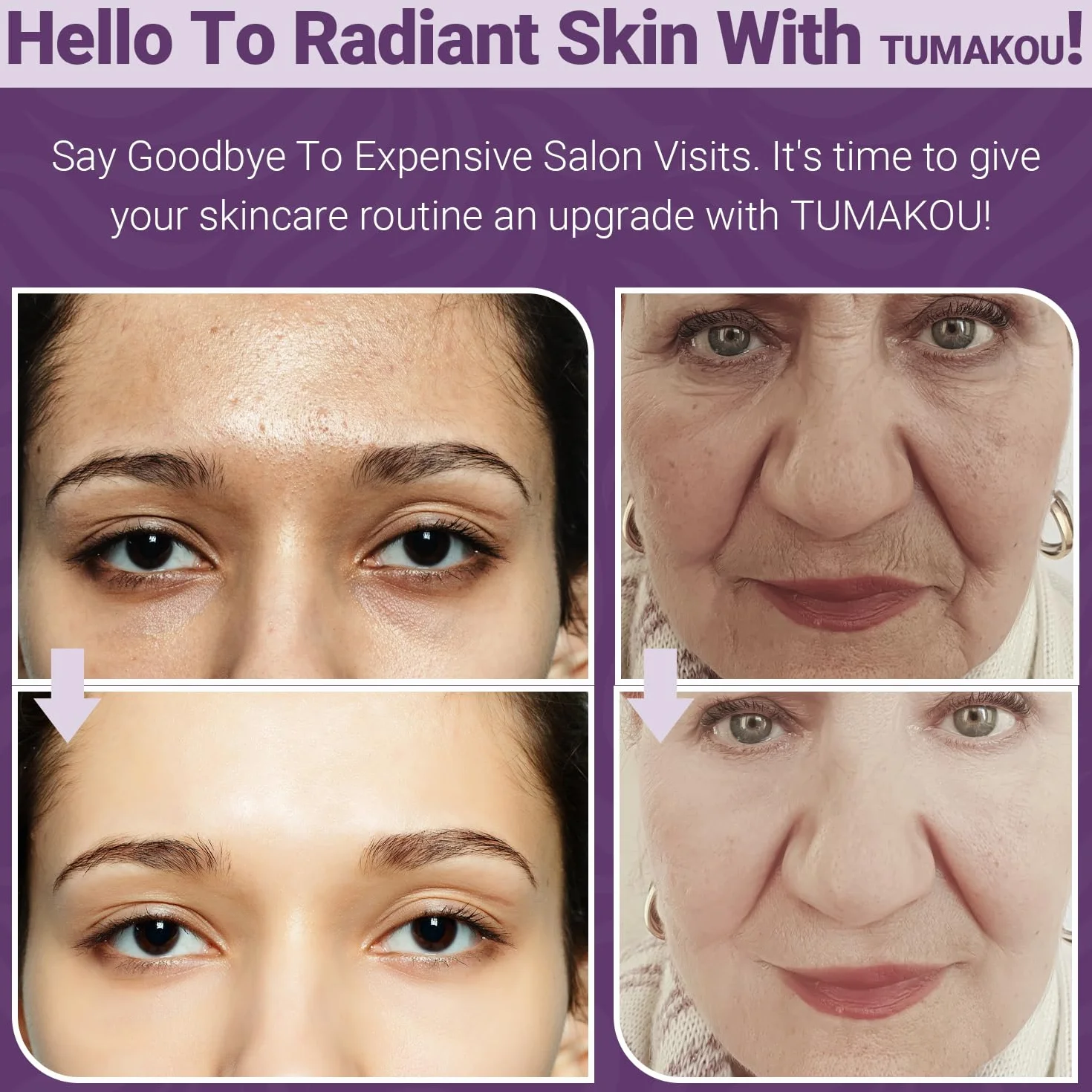 Radiofrecuencia Facial - TUMAKOU 4 en 1 EMS Microcorrientes Facial | Azul Luz Roja Terapia Masajeador Facial - Aparato Radiofrecuencia Facial - Masajeador Facial Reafirmante Antienvejecimiento